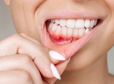 7707bb35-af23-4596-b28a-3a0503ef7a0f 7707bb35-af23-4596-b28a-3a0503ef7a0f