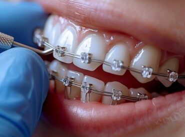 #dişhekimi #implanttedavisi #implant… #dişhekimi #implanttedavisi #implant…