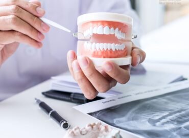 تجميل الأسنان