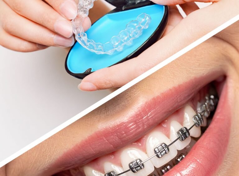 التقويم الشفاف والتقويم العادي التقويم الشفاف والتقويم العادي