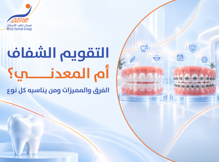 التقويم الشفاف التقويم الشفاف
