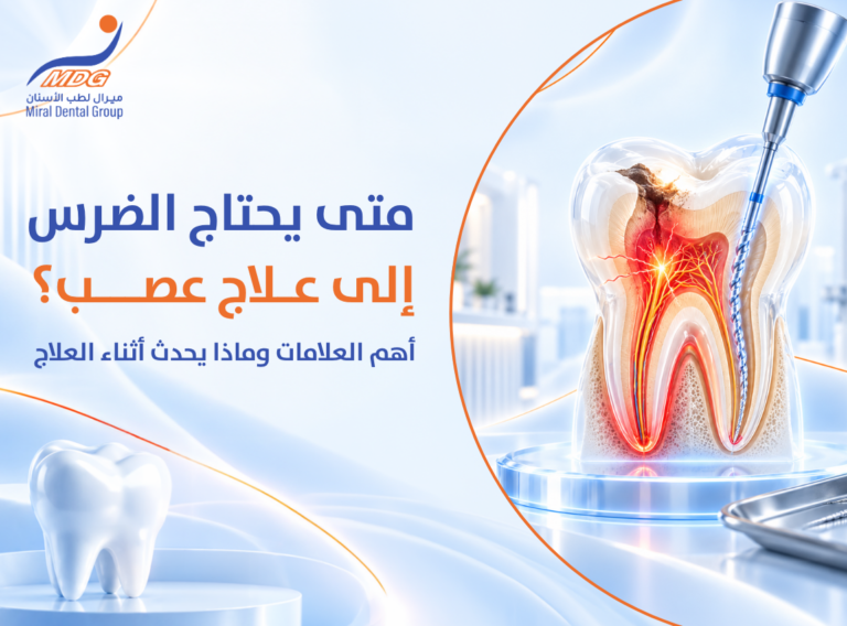علاج عصب الأسنان علاج عصب الأسنان