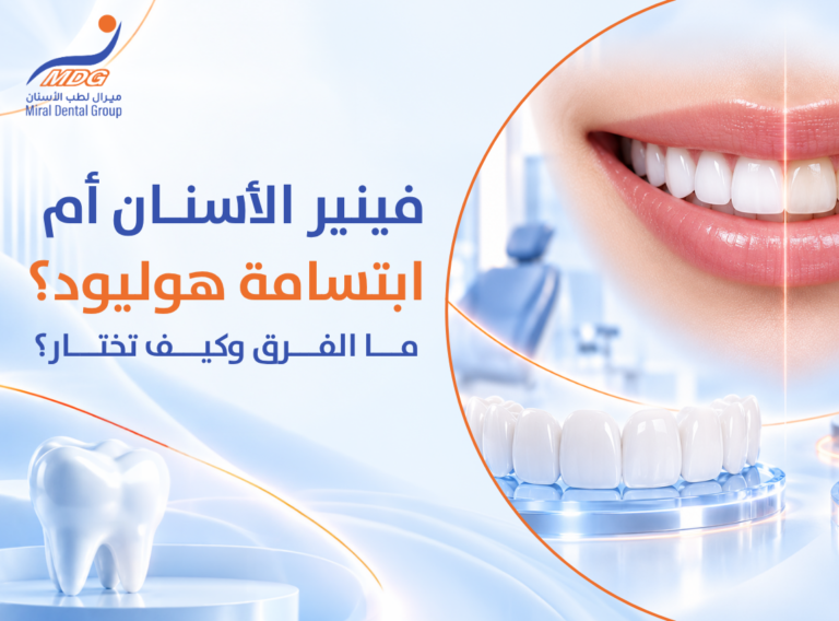 فينير الأسنان فينير الأسنان